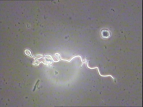 Image 1: Sarcoscypha austriaca hair